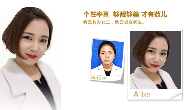 新北美鼻、V脸